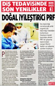 Doğal İyileştirici PRF Haberi