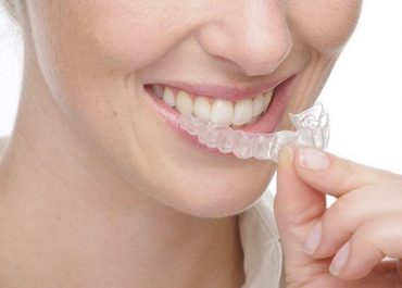 Şeffaf Plak İnvisalign