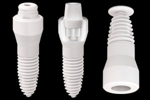 Zirkonyum – Seramik Porselen Diş İmplantları