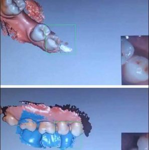 Digital Diş Hekimliği