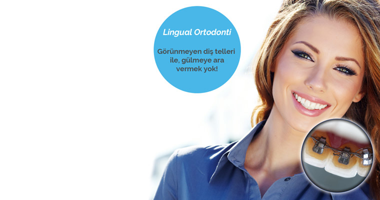 Lingual Ortodonti Görünmeyen Diş Teli